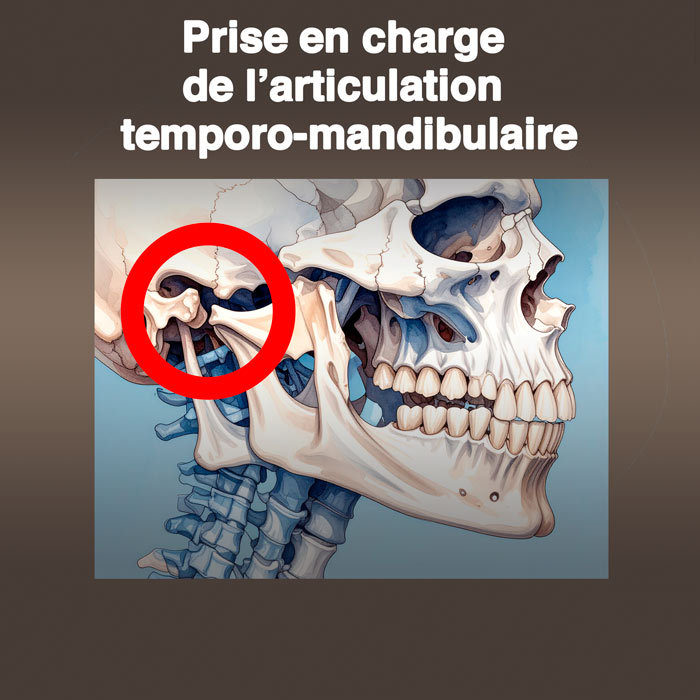 Prise en charge de l’articulation temporo-mandibulaire
